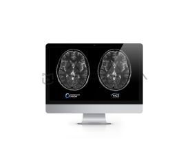 Canon Compressed Speeder