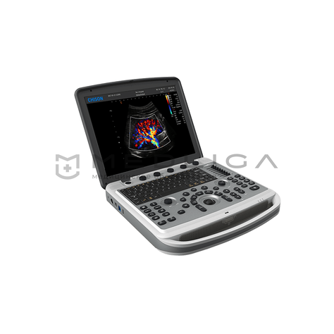 Chison Sonotouch 80 (SonoBook 6), 4