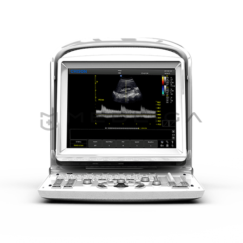 CHISON ECO 3 Expert, 2