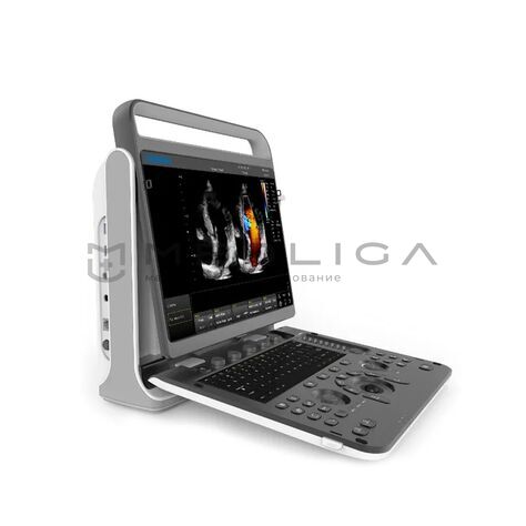 Chison SonoTouch 60 Pro, 3