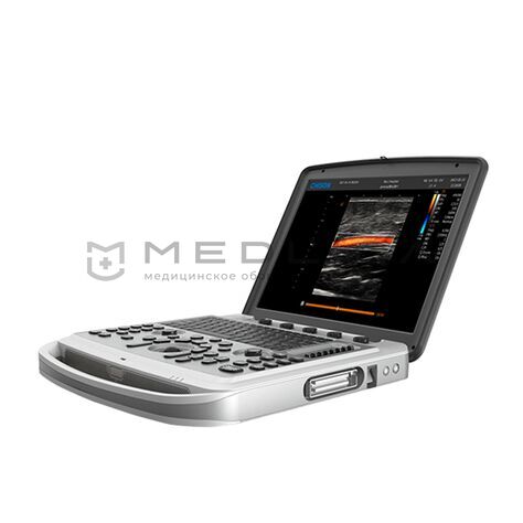 Chison Sonotouch 80 (SonoBook 6)