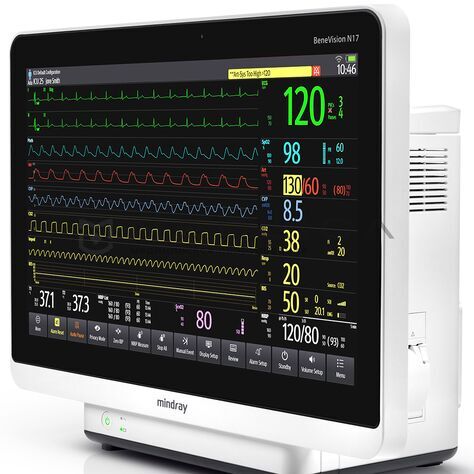 Mindray BeneVision N17, 4
