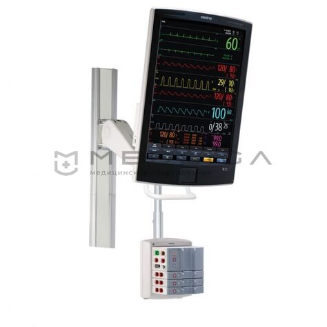 Mindray V21, 2